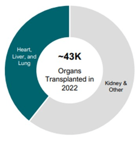 Organ Transplants in the US